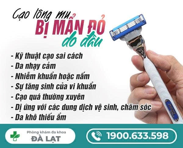 Cạo Lông Mu Bị Mẩn Đỏ 