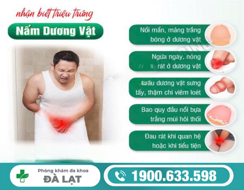 NẤM DƯƠNG VẬT Ở NAM GIỚI: DẤU HIỆU NHẬN BIẾT SỚM