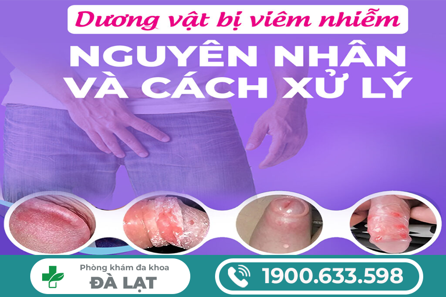 VIÊM NHIỄM Ở ĐẦU KHẤC: NHẬN BIẾT SỚM ĐỂ TRÁNH BIẾN CHỨNG NGUY HIỂM 