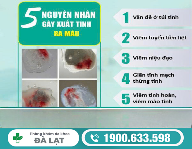 NGUYÊN NHÂN CHÍNH KHIẾN NAM GIỚI XUẤT TINH RA MÁU