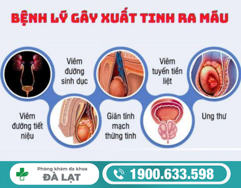TINH TRÙNG CÓ MÁU LÀ BỆNH GÌ? NHỮNG NGUY CƠ TIỀM ẨN CHO NAM GIỚI