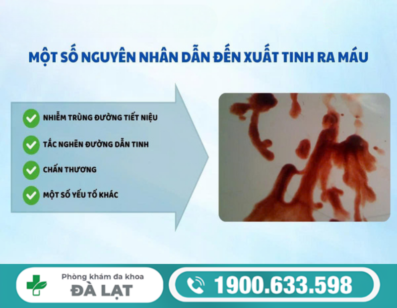 CÁCH CHỮA TINH TRÙNG RA MÁU HIỆU QUẢ NHANH NAM GIỚI CẦN BIẾT