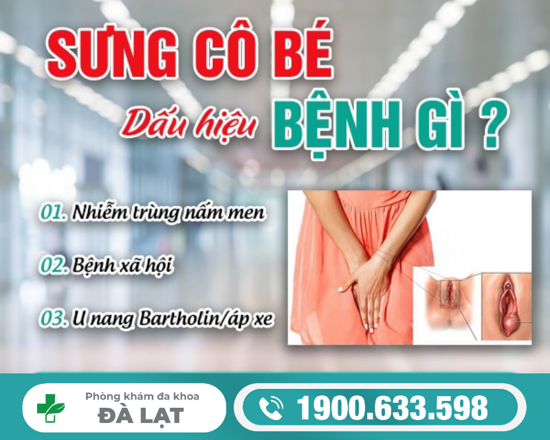 Sưng Cô Bé: Nguyên Nhân, Biểu Hiện, Biến Chứng Và Cách Điều Trị 