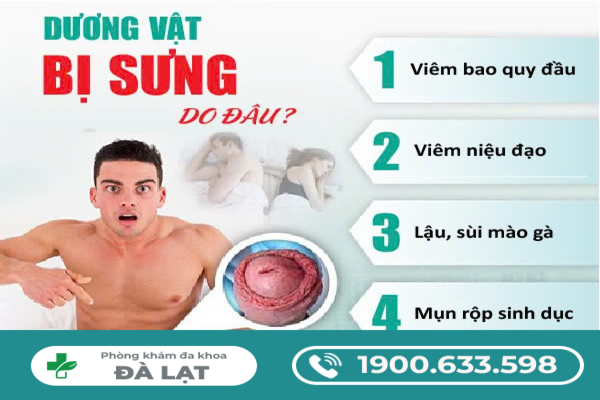 CÁCH CHỮA SƯNG DƯƠNG VẬT AN TOÀN VÀ HIỆU QUẢ HIỆN NAY
