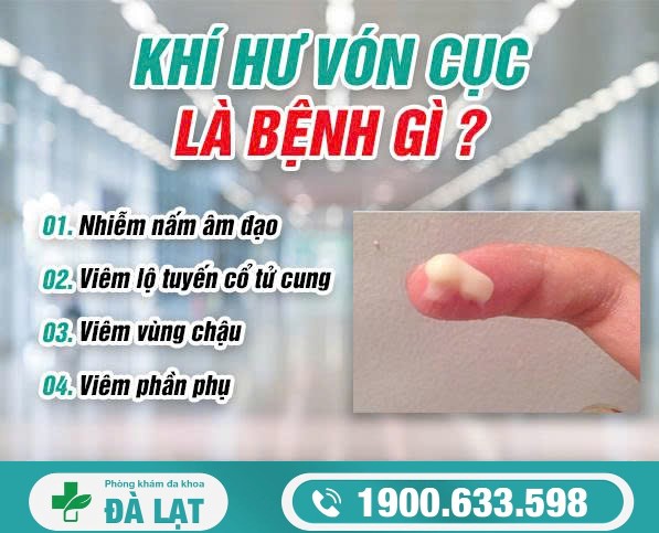 Khí Hư Vón Cục: Dấu Hiệu Cảnh Báo Bệnh Phụ Khoa 