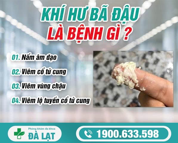 Hiện Tượng Khí Hư Bã Đậu Ở Nữ Giới 