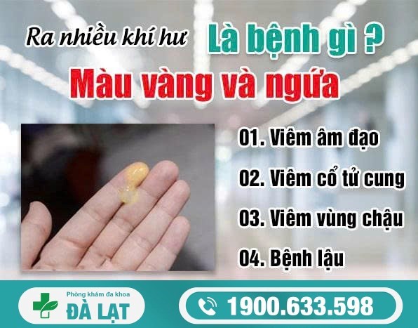 Hiện Tượng Ra Nhiều Khí Hư Màu Vàng Và Ngứa 