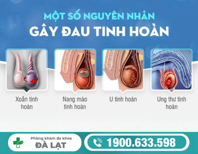 TƯ VẤN ĐAU TINH HOÀN Ở NAM GIỚI 
