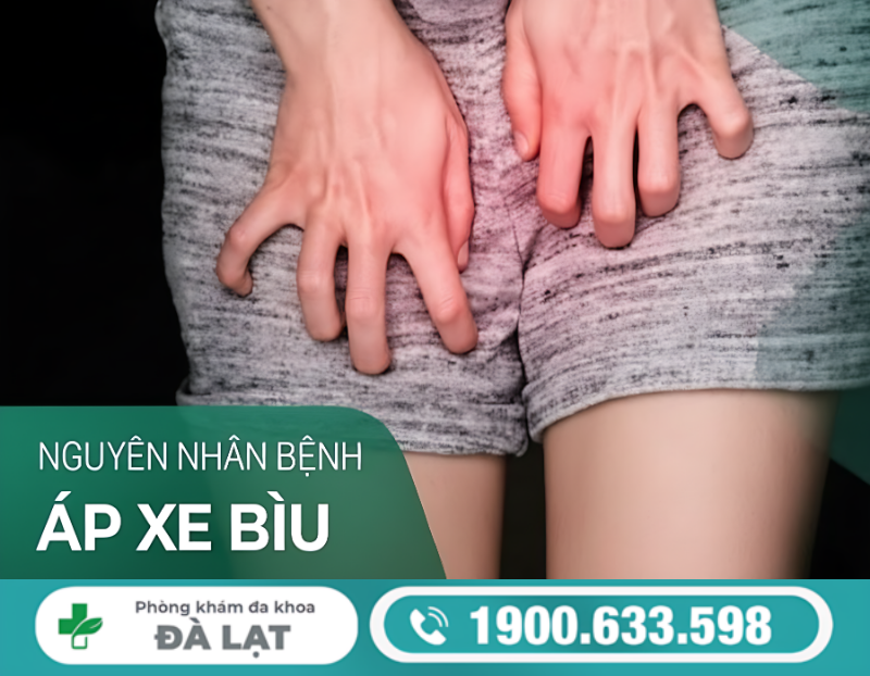 ÁP XE BÌU Ở NAM GIỚI LÀ GÌ? DẤU HIỆU NHẬN BIẾT SỚM ĐỂ TRÁNH BIẾN CHỨNG