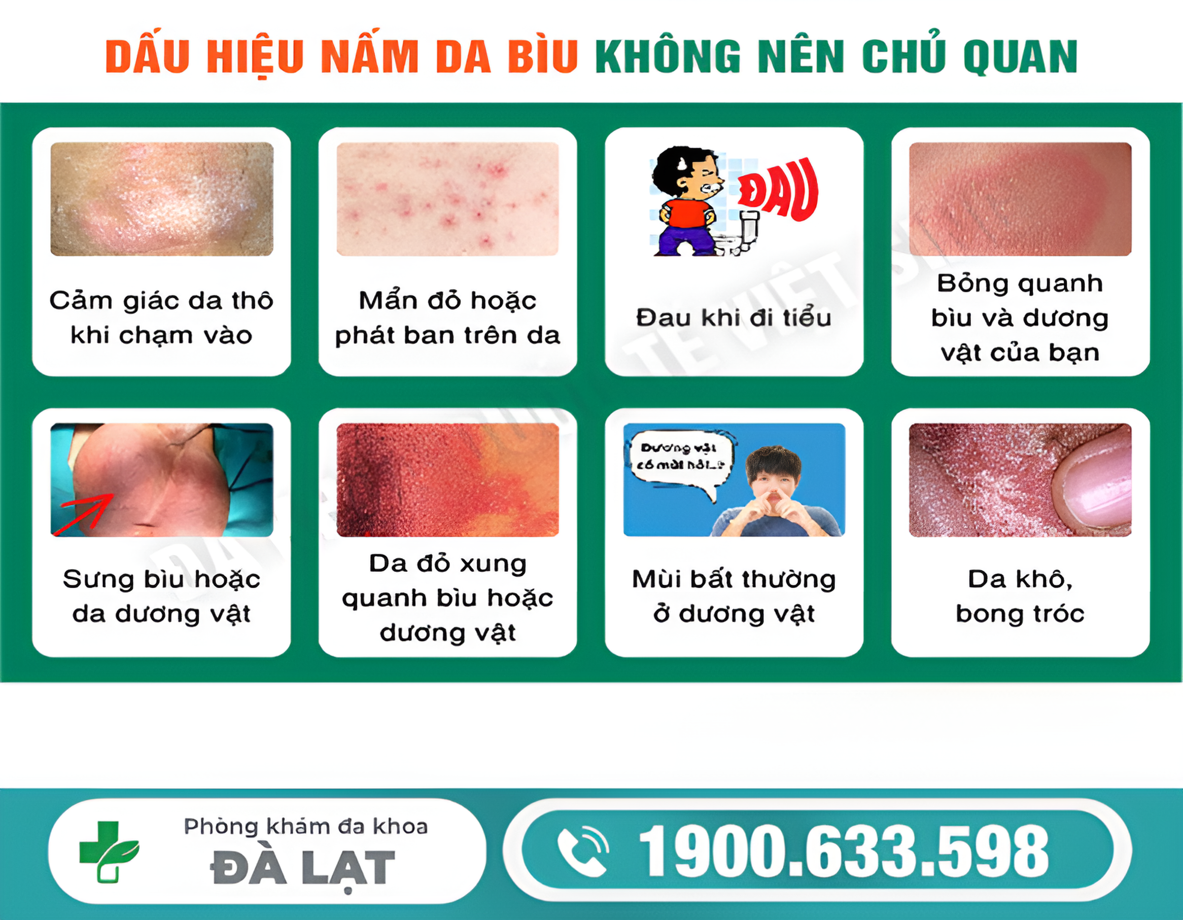 BỆNH NẤM BÌU Ở NAM GIỚI KHÔNG NÊN CHỦ QUAN 