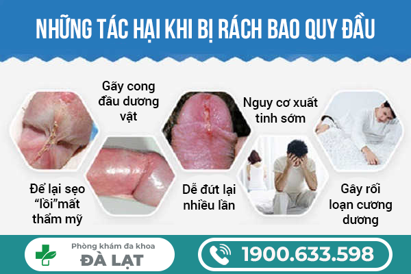CÁCH CHỮA RÁCH BAO QUY ĐẦU AN TOÀN VÀ HẠN CHẾ BIẾN CHỨNG 