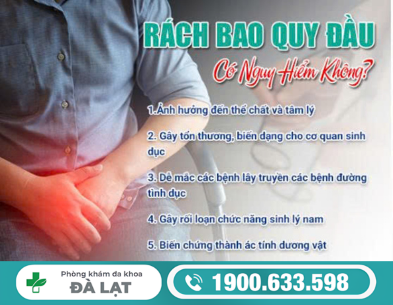 RÁCH BAO QUY ĐẦU CÓ NGUY HIỂM KHÔNG? NAM GIỚI KHÔNG NÊN CHỦ QUAN 