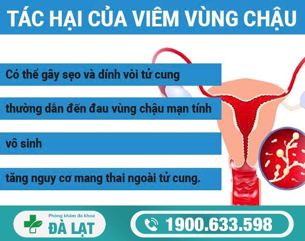 Viêm Vùng Chậu Có Nguy Hiểm Không? 