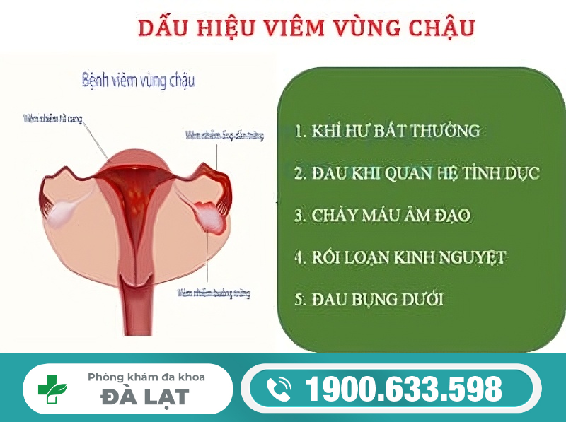 Viêm Vùng Chậu: Nguyên Nhân, Dấu Hiệu, và Cách Điều Trị 