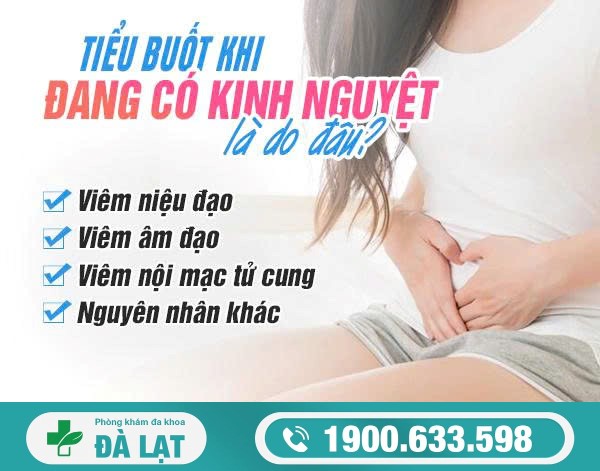 Tiểu Buốt Khi Đang Có Kinh Nguyệt 