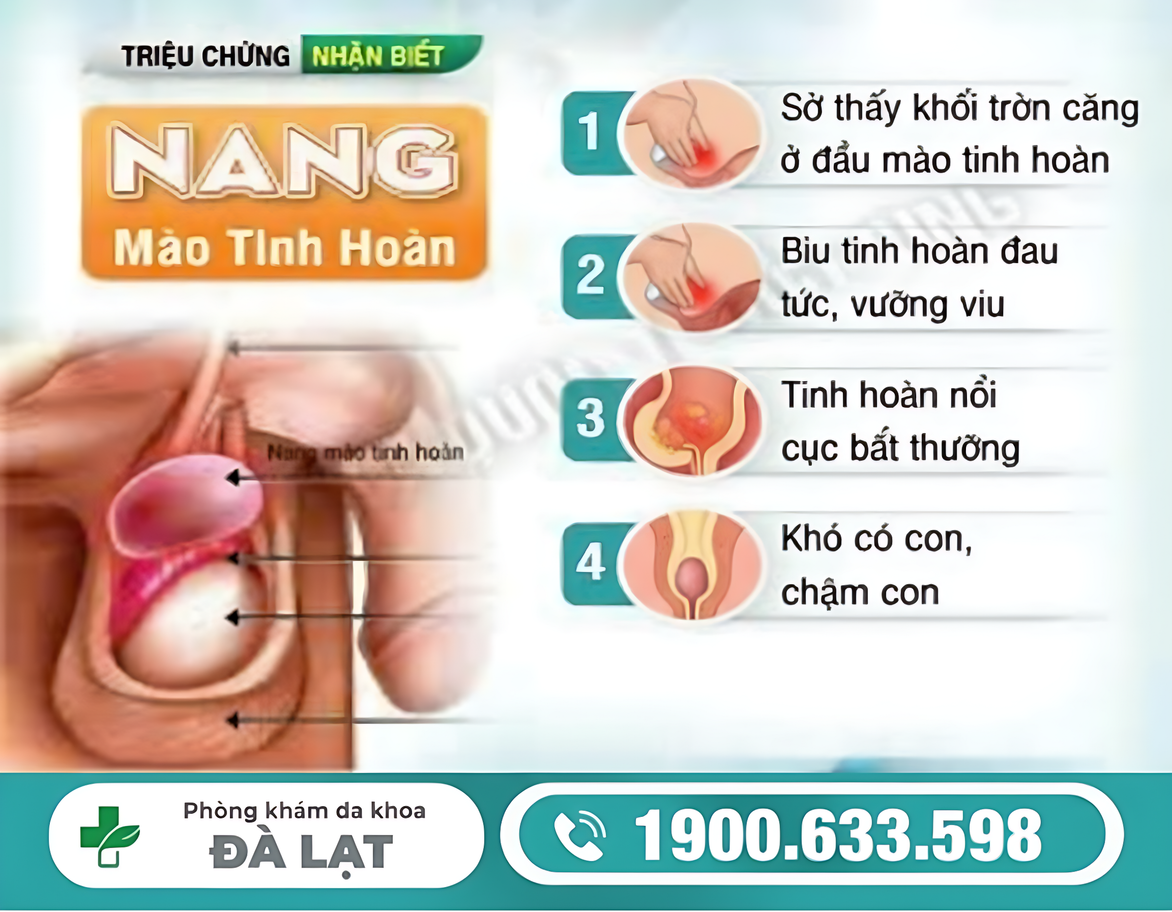 BỆNH NANG THỪNG TINH HOÀN Ở NAM GIỚI: NGUYÊN NHÂN VÀ CÁCH ĐIỀU TRỊ 