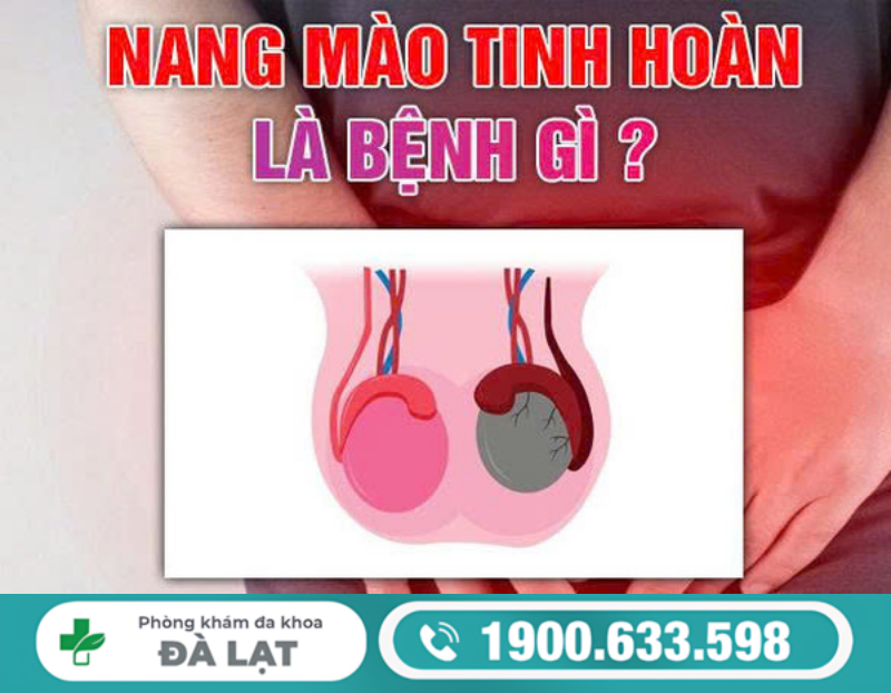 NANG MÀO TINH HOÀN BÊN TRÁI: NGUYÊN NHÂN VÀ CÁCH ĐIỀU TRỊ 