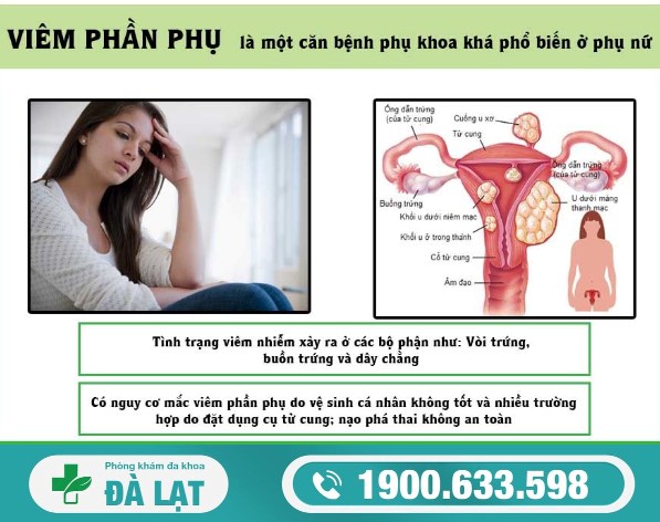 Viêm Phần Phụ: Nguyên Nhân, Dấu Hiệu và Cách Chữa 