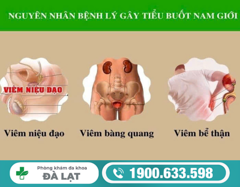 TIỂU BUỐT NƯỚC TIỂU VÀNG Ở NAM VÀ NỮ CẢNH BÁO VẤN ĐỀ SỨC KHỎE GÌ?