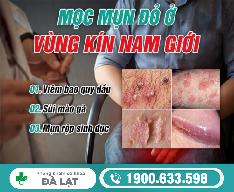 Dương Vật Bị Nổi Mụn Đỏ 