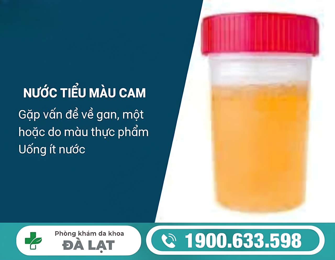 PHỤ NỮ ĐI TIỂU MÀU CAM CẢNH BÁO BỆNH LÝ GÌ?
