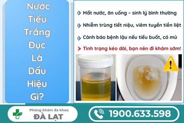 NƯỚC TIỂU MÀU TRẮNG ĐỤC Ở NỮ LÀ DẤU HIỆU BỆNH GÌ?
