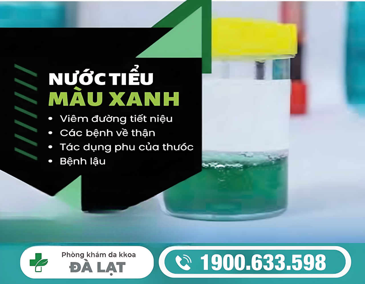 NƯỚC TIỂU MÀU XANH Ở NỮ: NGUYÊN NHÂN VÀ CÁCH ĐIỀU TRỊ 