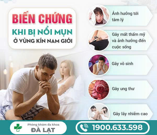Nổi Mụn Trắng Ở Bao Quy Đầu Nam Giới 