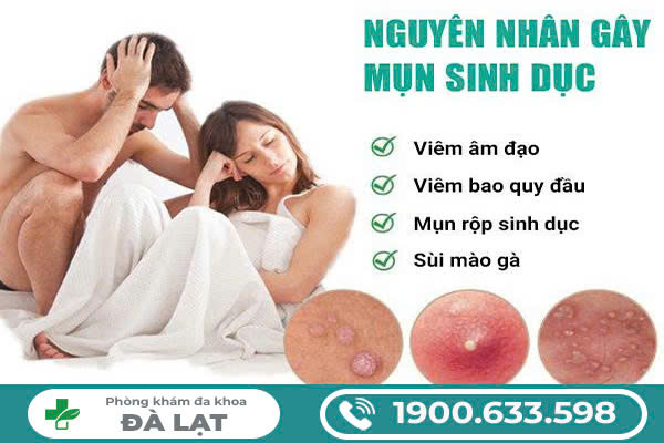 Nguyên Nhân Mọc Mụn Sinh Dục Ở Cả Nam và Nữ 