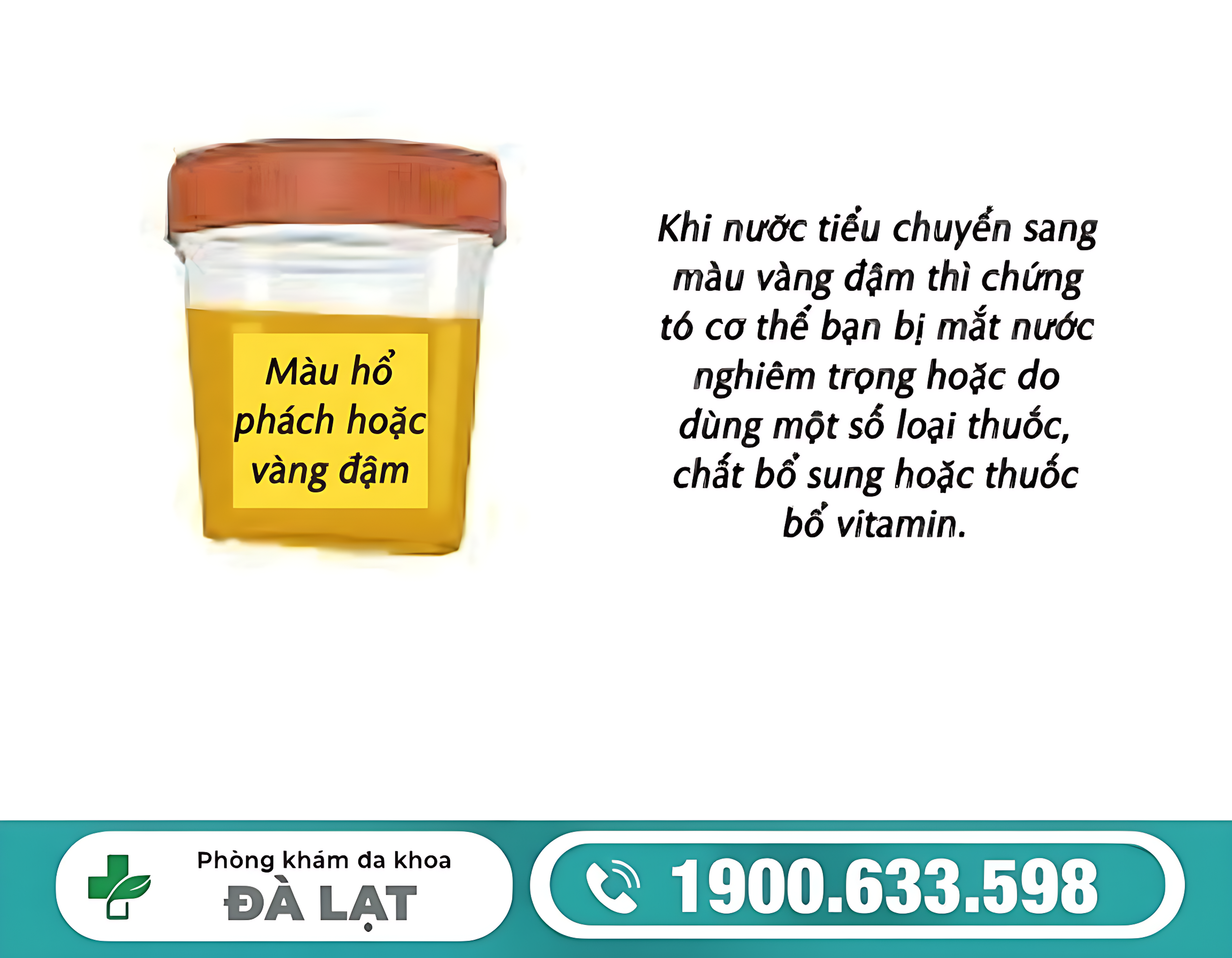 ĐI TIỂU MÀU VÀNG ĐẬM Ở NAM VÀ NỮ LÀ DẤU HIỆU BỆNH GÌ?