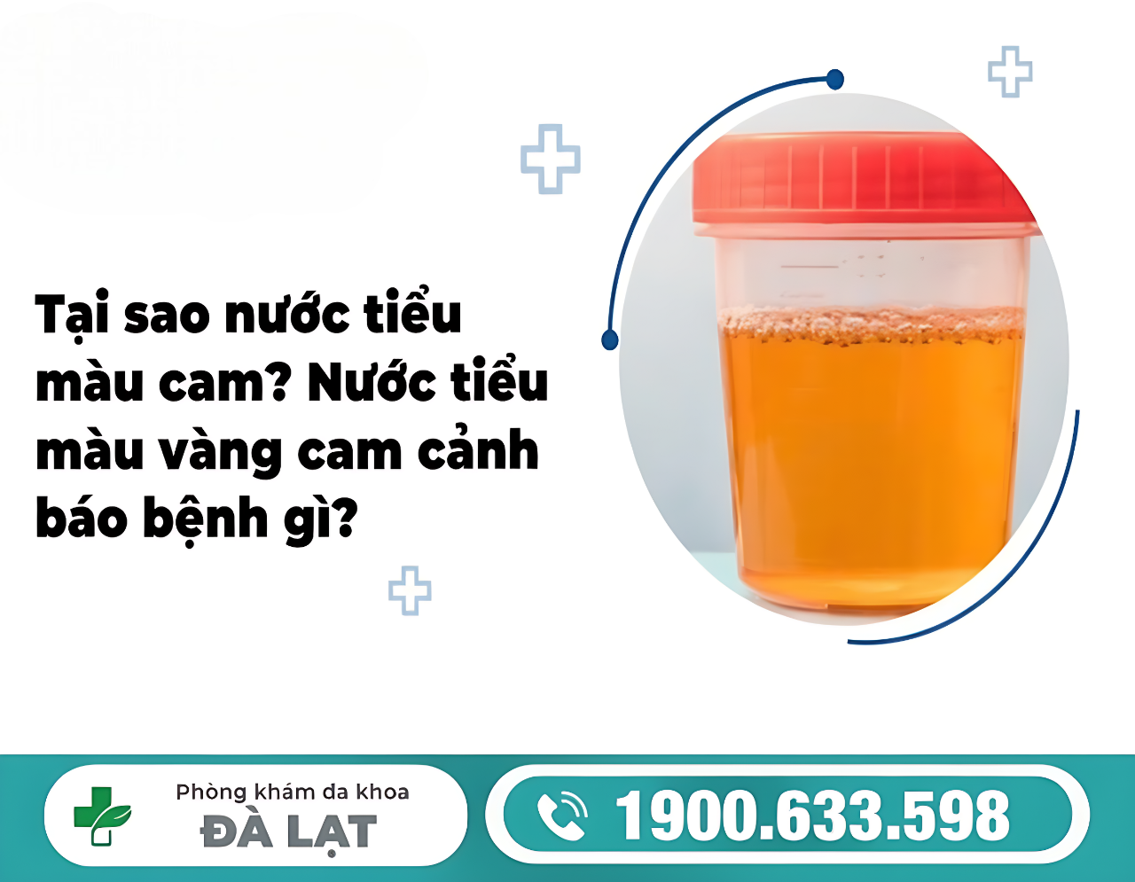 NƯỚC TIỂU CÓ MÀU CAM Ở NAM VÀ NỮ LÀ DẤU HIỆU BỆNH GÌ?