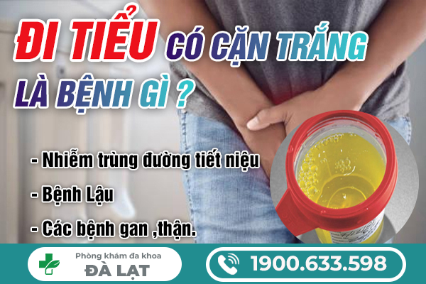ĐI TIỂU CÓ CẶN TRẮNG Ở NAM VÀ NỮ LÀ BỆNH GÌ?