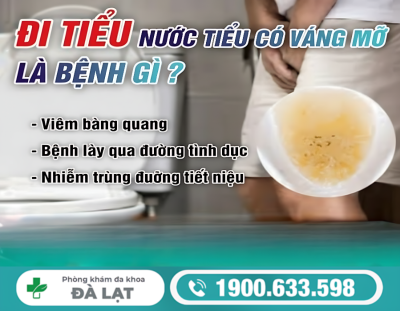 NAM VÀ NỮ ĐI TIỂU CÓ VÁNG MỠ LÀ DẤU HIỆU BỆNH LÝ GÌ?