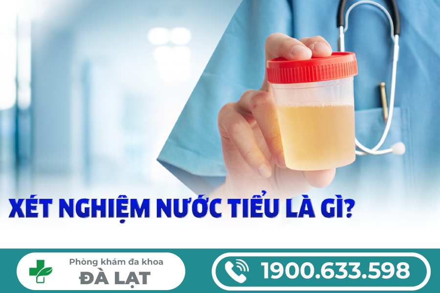 XÉT NGHIỆM NƯỚC TIỂU BIẾT ĐƯỢC BỆNH GÌ Ở NAM VÀ NỮ?