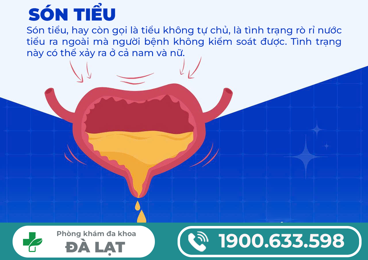 RÒ RỈ NƯỚC TIỂU Ở NAM VÀ NỮ