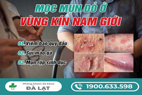 Nổi Mẩn Đỏ Ở Vùng Kín Nam Giới 