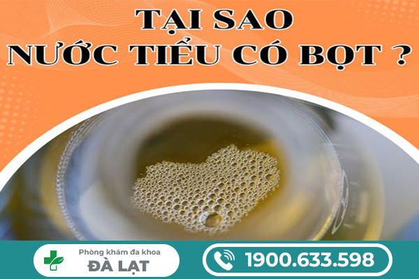 NƯỚC TIỂU CÓ BỌT Ở NAM VÀ NỮ LÀ DẤU HIỆU BỆNH GÌ?