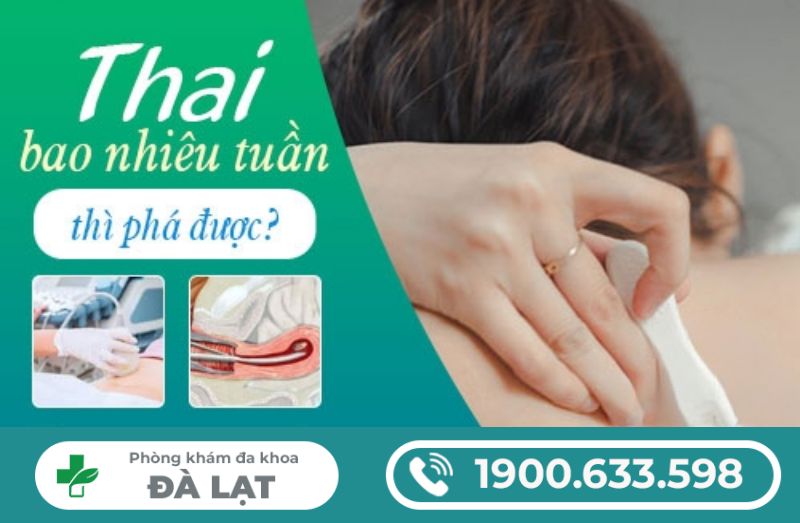 NẠO HÚT THAI THEO TUẦN TUỔI: KHI NÀO NÊN THỰC HIỆN?