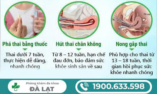 ĐÌNH CHỈ THAI TỪ 12 TUẦN ĐẾN 18 TUẦN AN TOÀN