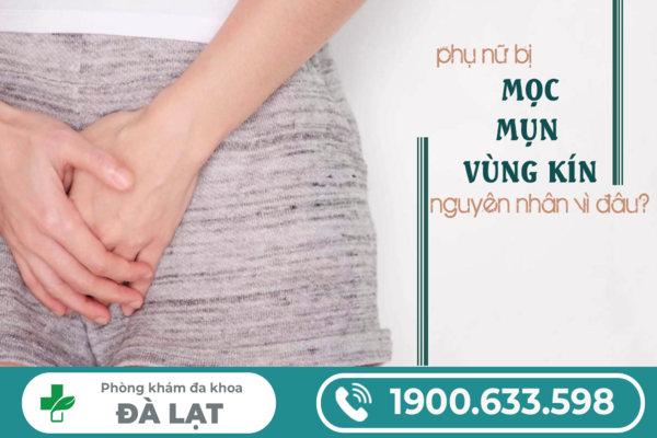 Bị Nổi Mụn Ở Môi Lớn Vùng Kín Nữ Giới 