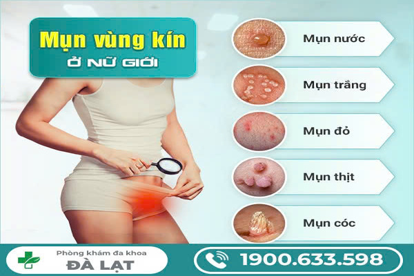 Mọc Mụn Ở Môi Bé Vùng Kín Nữ Giới 