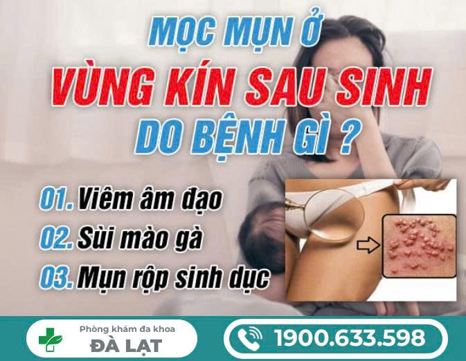 Mọc Mụn Ở Vùng Kín Sau Sinh 