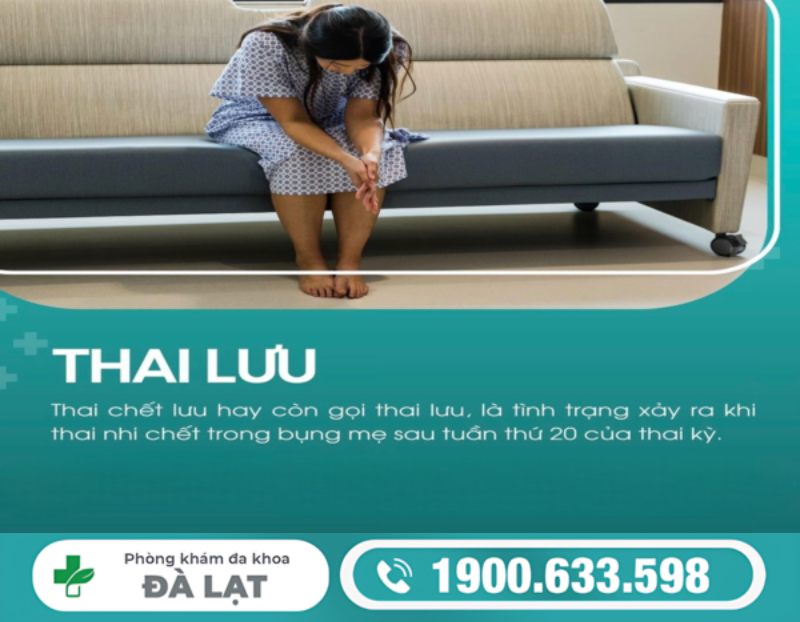 THAI LƯU LÀ GÌ? NHỮNG THÔNG TIN CƠ BẢN PHỤ NỮ CẦN BIẾT