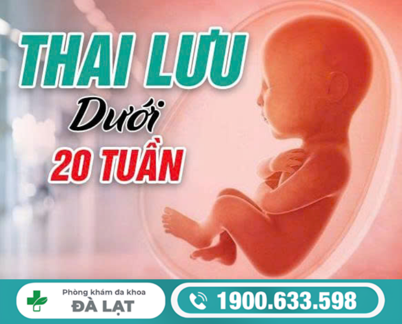 THAI LƯU DƯỚI 20 TUẦN: NGUYÊN NHÂN VÀ CÁCH ĐIỀU TRỊ