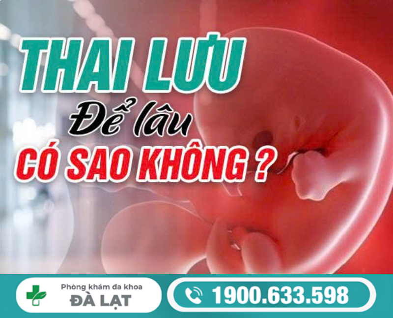 THAI LƯU ĐỂ LÂU CÓ NGUY HIỂM KHÔNG?