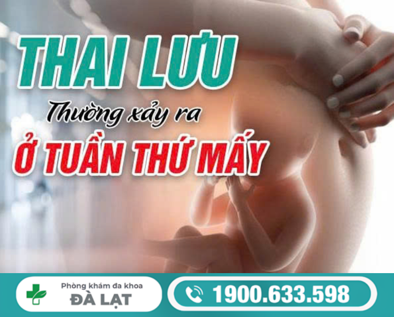 THAI LƯU THƯỜNG XẢY RA Ở TUẦN THỨ MẤY THAI KỲ?