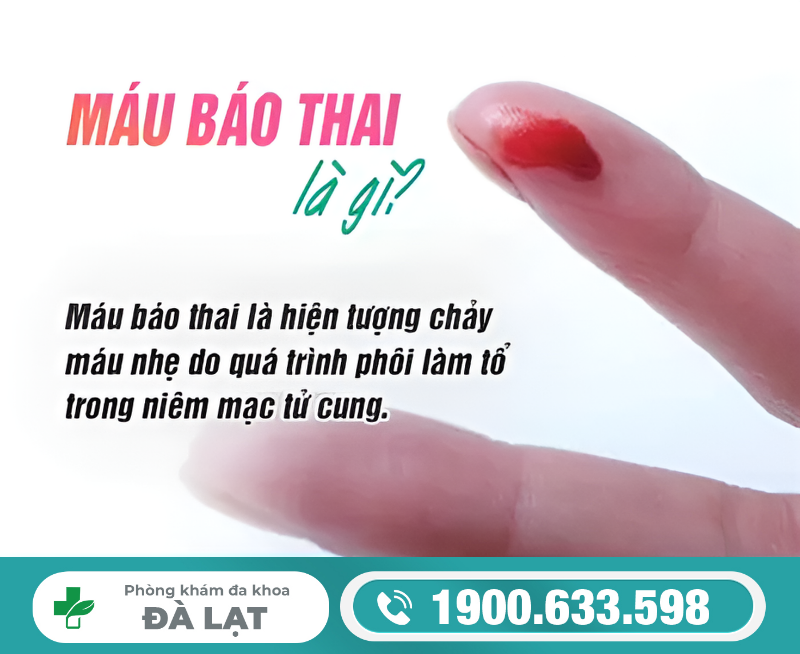 MÁU BÁO THAI CÓ PHẢI DẤU HIỆU MANG THAI KHÔNG?