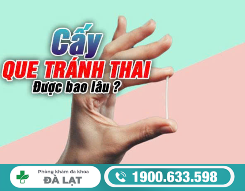 CẤY QUE TRÁNH THAI ĐƯỢC HIỆU QUẢ BAO LÂU?