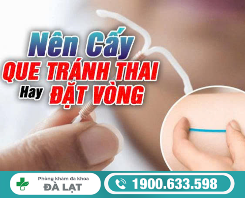 NỮ GIỚI NÊN CẤY QUE HAY ĐẶT VÒNG TRÁNH THAI?