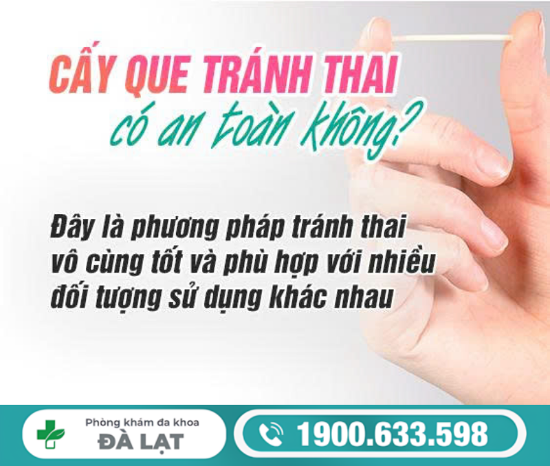 CẤY QUE TRÁNH THAI CÓ AN TOÀN CHO NỮ GIỚI KHÔNG?